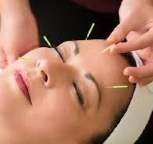 Acupuntura Anti-Arrugas